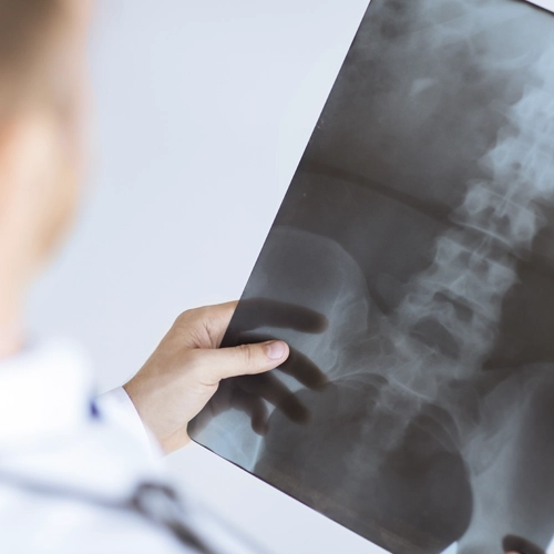 Personal Injury Tampa FL X Ray