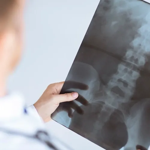 A doctor reviewing an x-ray of a patient's spine